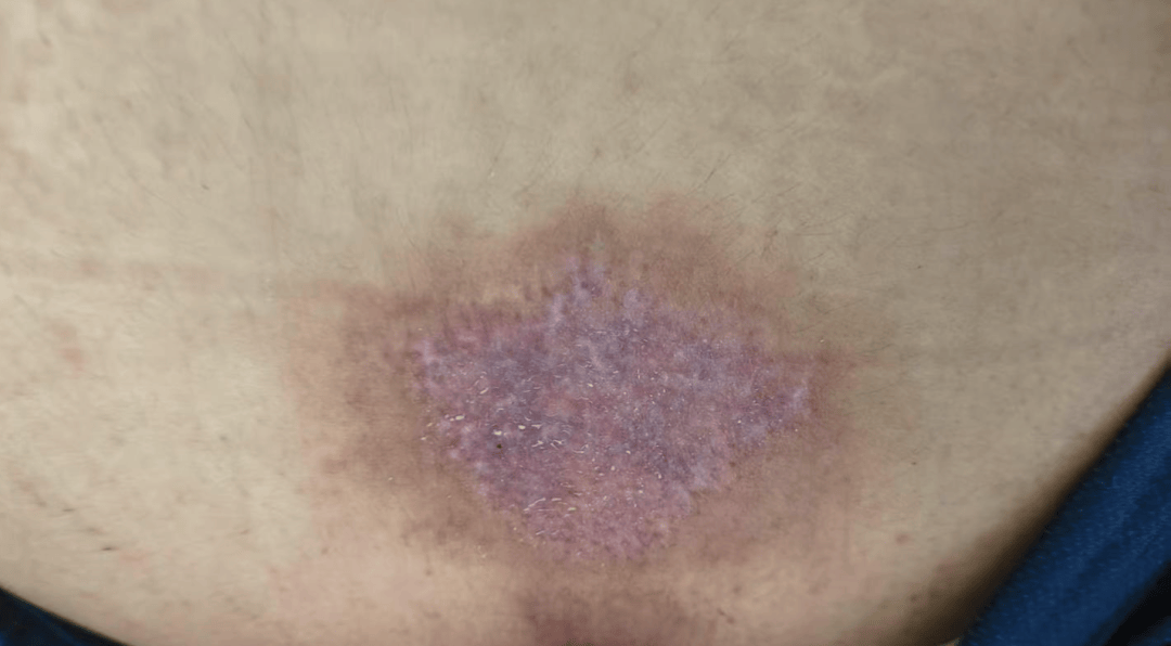 皇冠信用網账号注册_14岁女孩在拓展营遭体罚去世皇冠信用網账号注册，班主任因截留其给父母信件受审