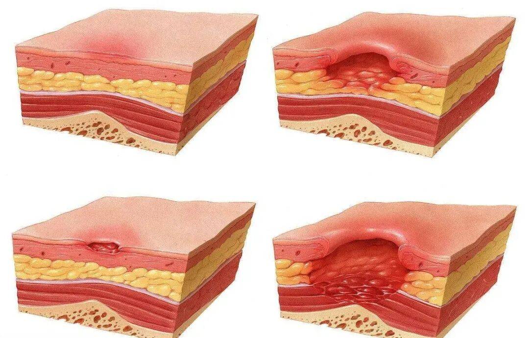 皇冠hga038
_一觉醒来皇冠hga038
,21岁女生的屁股惨不忍睹!严重或危及生命