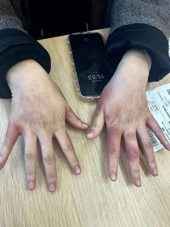 皇冠mos066
_东北姑娘来浙江后崩溃了皇冠mos066
,穿3条加绒裤还冻到发抖!南方人冬天怎么保命,网友吵翻!