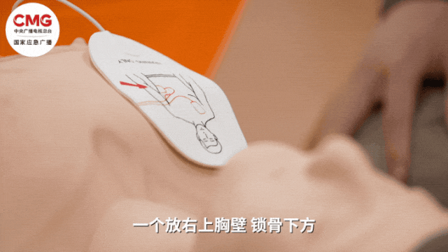 信用平台出租_山东一市民突发心梗信用平台出租，其家属砸窗取出陌生人车内AED用于急救；车主回应：砸就砸吧，人命比玻璃重要