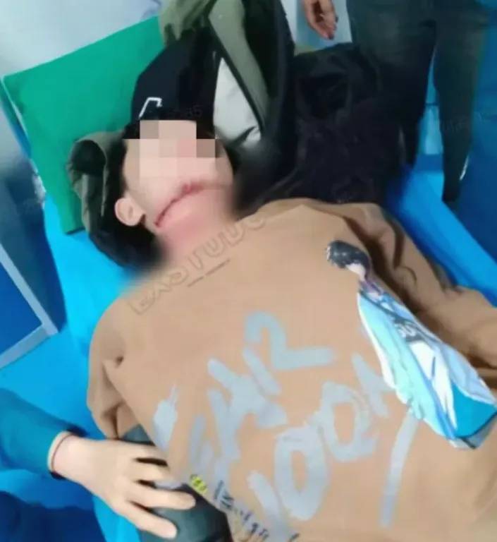 皇冠信用网登2
_河南13岁被锁喉男孩赴京治疗后已脱离生命危险皇冠信用网登2
,拉绳老人已被采取刑事强制措施